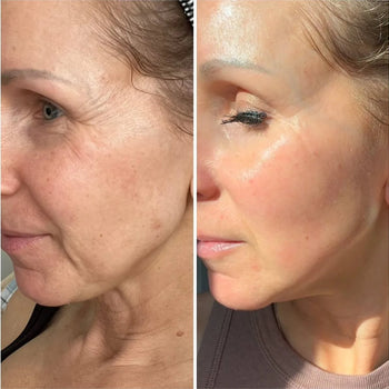 Before and after product results